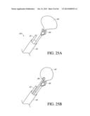 IMPLANT WITH HIGH VAPOR PRESSURE MEDIUM diagram and image