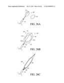 IMPLANT WITH HIGH VAPOR PRESSURE MEDIUM diagram and image