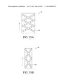 IMPLANT WITH HIGH VAPOR PRESSURE MEDIUM diagram and image