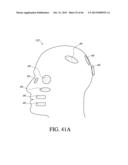 IMPLANT WITH HIGH VAPOR PRESSURE MEDIUM diagram and image