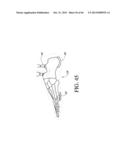 IMPLANT WITH HIGH VAPOR PRESSURE MEDIUM diagram and image