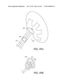 IMPLANT WITH HIGH VAPOR PRESSURE MEDIUM diagram and image