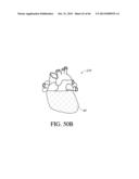 IMPLANT WITH HIGH VAPOR PRESSURE MEDIUM diagram and image