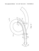 APPARATUS AND METHODS FOR CRYOGENICALLY ABLATING TISSUE AND ADJUSTING     CRYOGENIC ABLATION REGIONS diagram and image