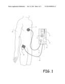 METHOD AND SYSTEM FOR INVASIVE SKIN TREATMENT diagram and image