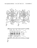 SYSTEM FOR BINDING BONE diagram and image