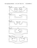 SYSTEM FOR BINDING BONE diagram and image