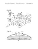 SYSTEM FOR BINDING BONE diagram and image