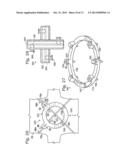 SYSTEM FOR BINDING BONE diagram and image