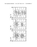 SYSTEM FOR BINDING BONE diagram and image