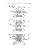 SYSTEM FOR BINDING BONE diagram and image