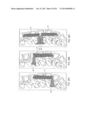 DEVICES FOR INTRODUCTION INTO A BODY VIA A SUBSTANTIALLY  STRAIGHT CONDUIT     TO FORM A PREDEFINED CURVED  CONFIGURATION, AND METHODS EMPLOYING SUCH     DEVICES diagram and image