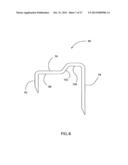 COMPLIANT ANASTOMOSIS SYSTEM UTILIZING SUTURE diagram and image