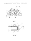 COMPLIANT ANASTOMOSIS SYSTEM UTILIZING SUTURE diagram and image