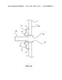 COMPLIANT ANASTOMOSIS SYSTEM UTILIZING SUTURE diagram and image