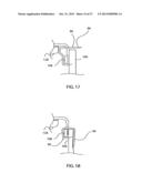 COMPLIANT ANASTOMOSIS SYSTEM UTILIZING SUTURE diagram and image