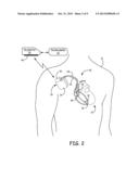 MAGNETIC FIELD DETECTOR FOR IMPLANTABLE MEDICAL DEVICES diagram and image