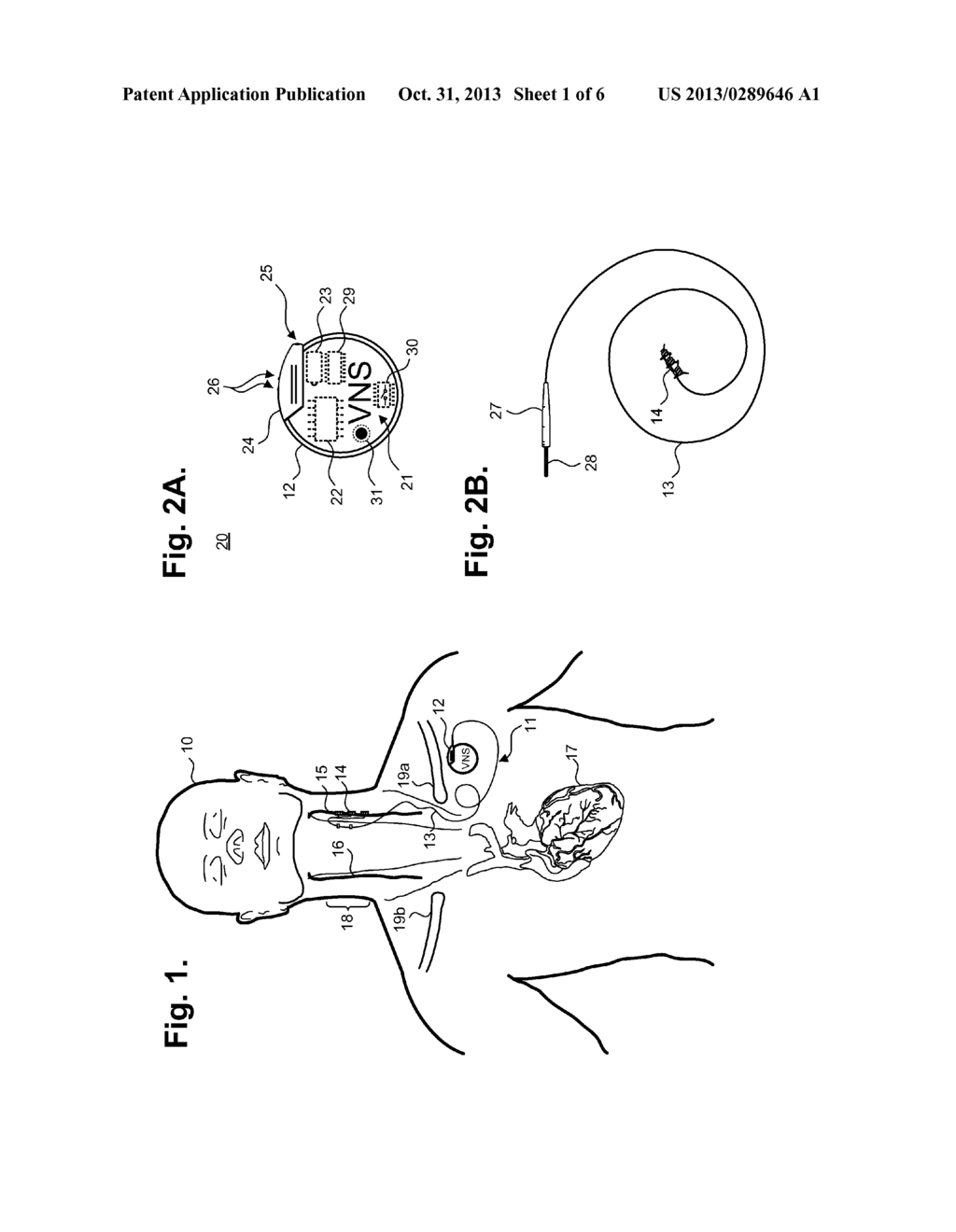 IMPLANTABLE NEUROSTIMULATOR FOR PROVIDING ELECTRICAL STIMULATION OF     CERVICAL VAGUS NERVES FOR TREATMENT OF CHRONIC CARDIAC DYSFUNCTION WITH     BOUNDED TITRATION - diagram, schematic, and image 02