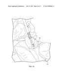 VISUALIZING TISSUE ACTIVATED BY ELECTRICAL STIMULATION diagram and image