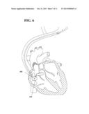 Optical Tissue Interface Method and Apparatus For Stimulating Cells diagram and image