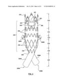 STENT-GRAFT PROSTHESIS FOR PLACEMENT IN THE ABDOMINAL AORTA diagram and image