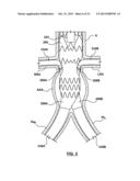 STENT-GRAFT PROSTHESIS FOR PLACEMENT IN THE ABDOMINAL AORTA diagram and image