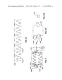 STENT-GRAFT PROSTHESIS FOR PLACEMENT IN THE ABDOMINAL AORTA diagram and image