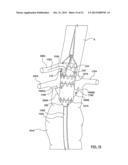 STENT-GRAFT PROSTHESIS FOR PLACEMENT IN THE ABDOMINAL AORTA diagram and image