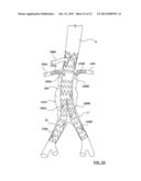 STENT-GRAFT PROSTHESIS FOR PLACEMENT IN THE ABDOMINAL AORTA diagram and image