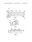 RING ON A CLOSED WEB STENT-GRAFT FOR USE IN TIP CAPTURE diagram and image