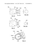 RING ON A CLOSED WEB STENT-GRAFT FOR USE IN TIP CAPTURE diagram and image