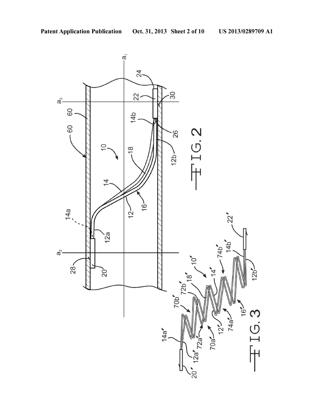 LOW PROFILE SUPPORT FRAME AND RELATED INTRALUMINAL MEDICAL DEVICES - diagram, schematic, and image 03