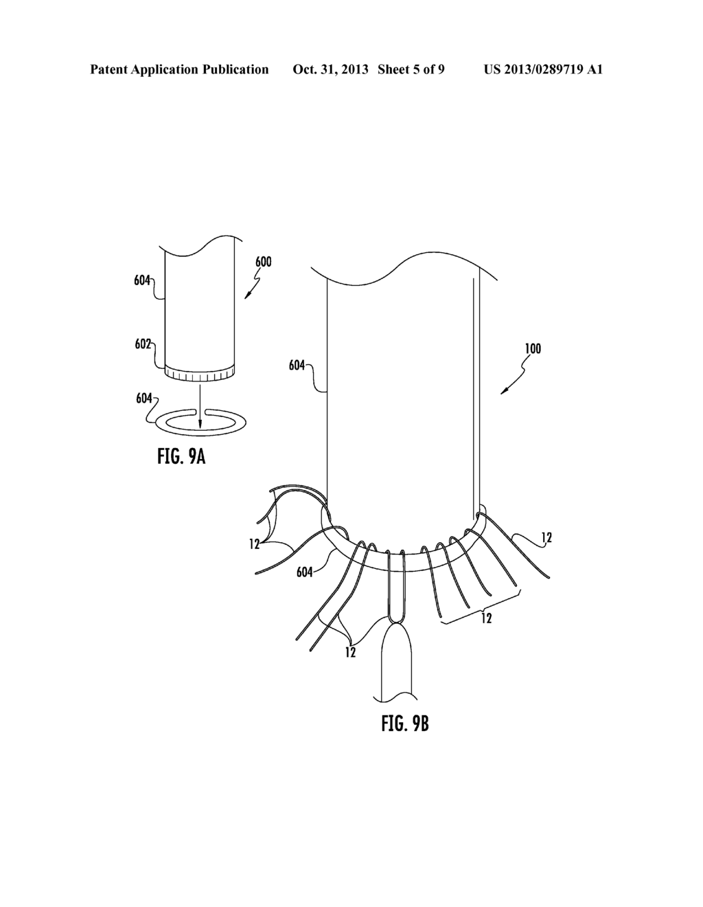 PROSTHETIC DEVICE FOR HEART VALVE REINFORCEMENT AND REMODELING PROCEDURES - diagram, schematic, and image 06