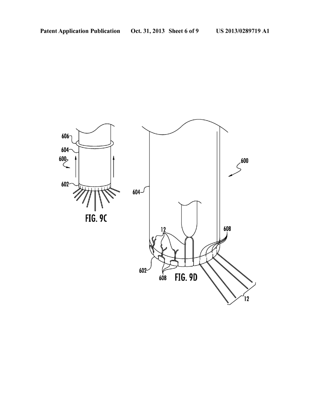 PROSTHETIC DEVICE FOR HEART VALVE REINFORCEMENT AND REMODELING PROCEDURES - diagram, schematic, and image 07