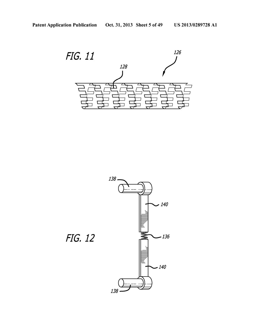 EXTRA-ARTICULAR IMPLANTABLE MECHANICAL ENERGY ABSORBING SYSTEMS - diagram, schematic, and image 06