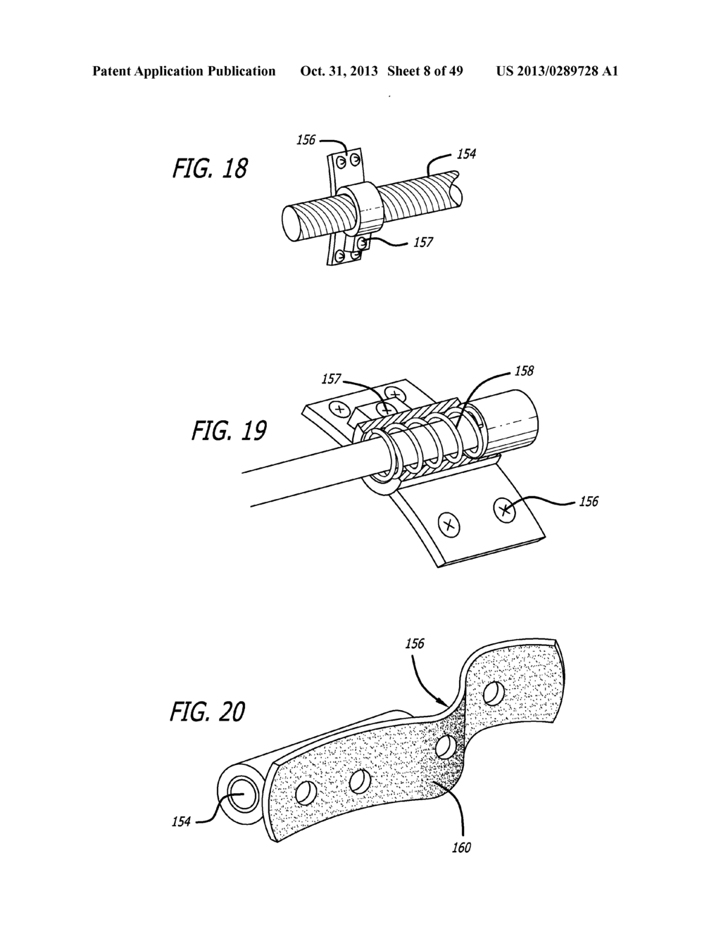 EXTRA-ARTICULAR IMPLANTABLE MECHANICAL ENERGY ABSORBING SYSTEMS - diagram, schematic, and image 09