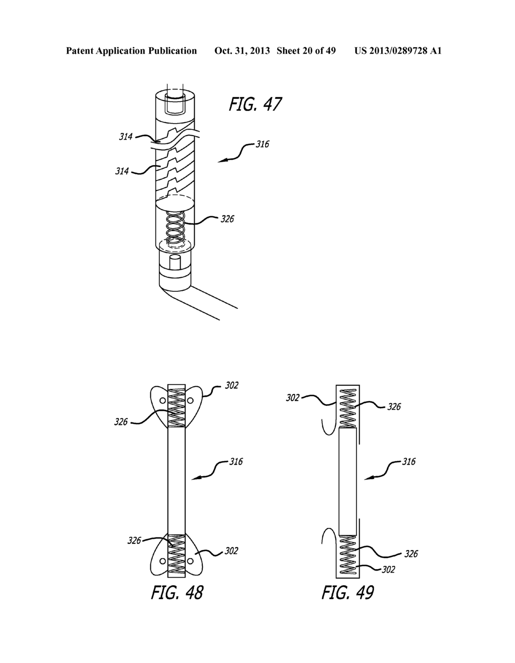 EXTRA-ARTICULAR IMPLANTABLE MECHANICAL ENERGY ABSORBING SYSTEMS - diagram, schematic, and image 21