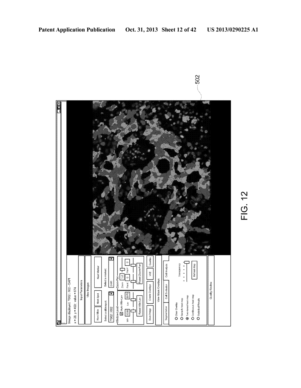 SYSTEMS AND METHODS FOR SELECTING AND ANALYZING PARTICLES IN A BIOLOGICAL     TISSUE - diagram, schematic, and image 13
