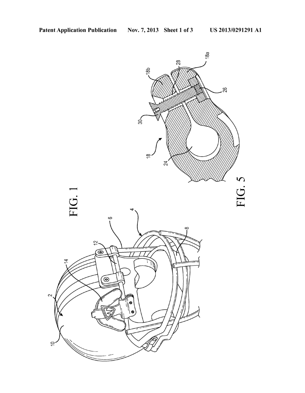 MOUTH GUARD RETAINING DEVICE - diagram, schematic, and image 02