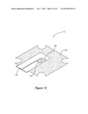 SYSTEMS AND METHODS TO MITIGATE HEAT LEAK BACK IN A THERMOELECTRIC     REFRIGERATION SYSTEM diagram and image