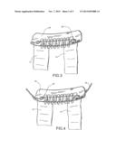 Article And Method For Stretching The Upper Face diagram and image