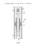 Degradable Balls for Use in Subterranean Applications diagram and image