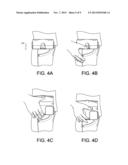 Personal Device Case diagram and image