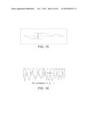 PROCESS OF FABRICATING IMPLANTS HAVING THREE DISTINCT SURFACES diagram and image