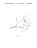 METHODS FOR MANUFACTURING CUSTOM CUTTING GUIDES IN ORTHOPEDIC APPLICATIONS diagram and image