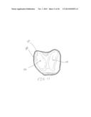 METHODS FOR MANUFACTURING CUSTOM CUTTING GUIDES IN ORTHOPEDIC APPLICATIONS diagram and image