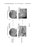 MOLDING OF MICRON AND NANO SCALE FEATURES diagram and image