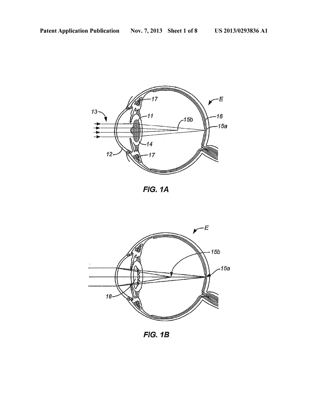 LIMITED ECHELETTE LENS, SYSTEMS AND METHODS - diagram, schematic, and image 02