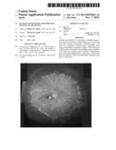 SYSTEMS AND METHODS FOR WIDEFIELD MAPPING OF THE RETINA diagram and image