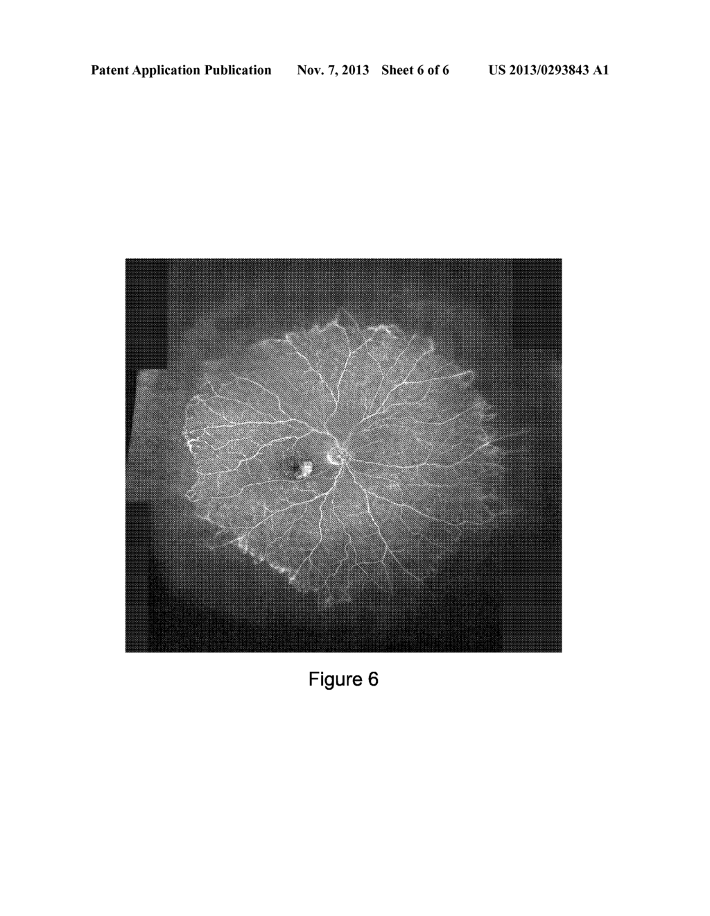 SYSTEMS AND METHODS FOR WIDEFIELD MAPPING OF THE RETINA - diagram, schematic, and image 07